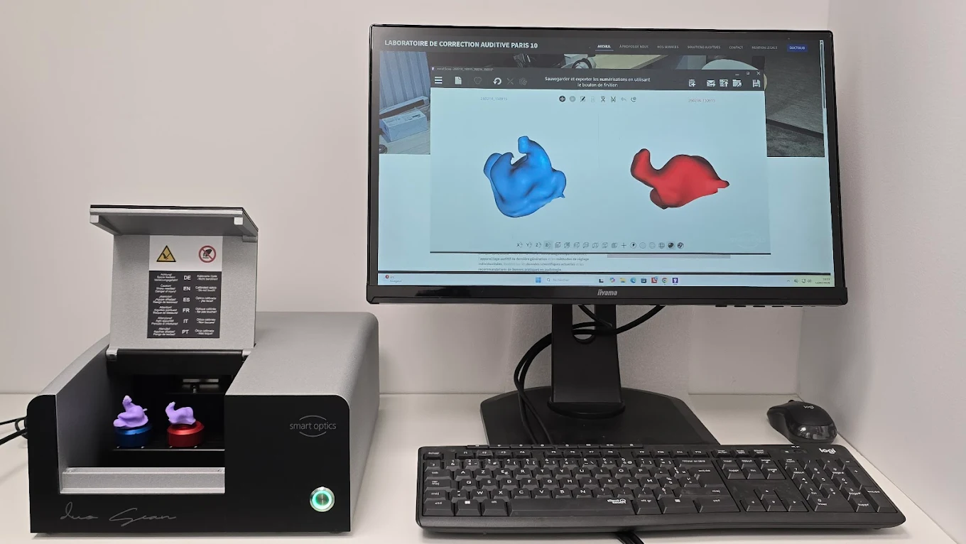Scanner 3D pour empreintes sur mesure, LCA Audition Paris 10